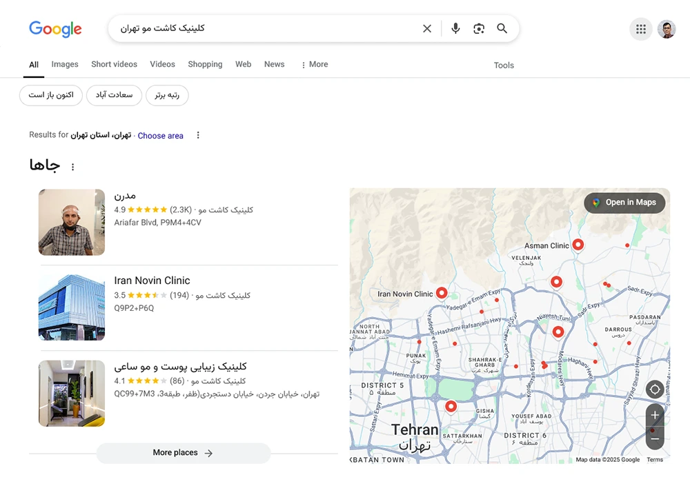 ثبت کلینیک کاشت مو روی نقشه گوگل