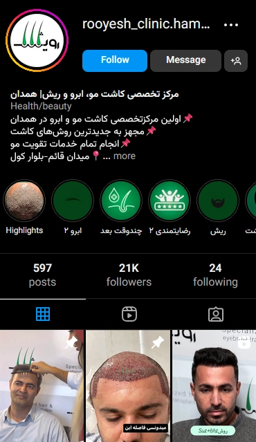 تبلیغات کاشت مو با شبکه‌های اجتماعی
